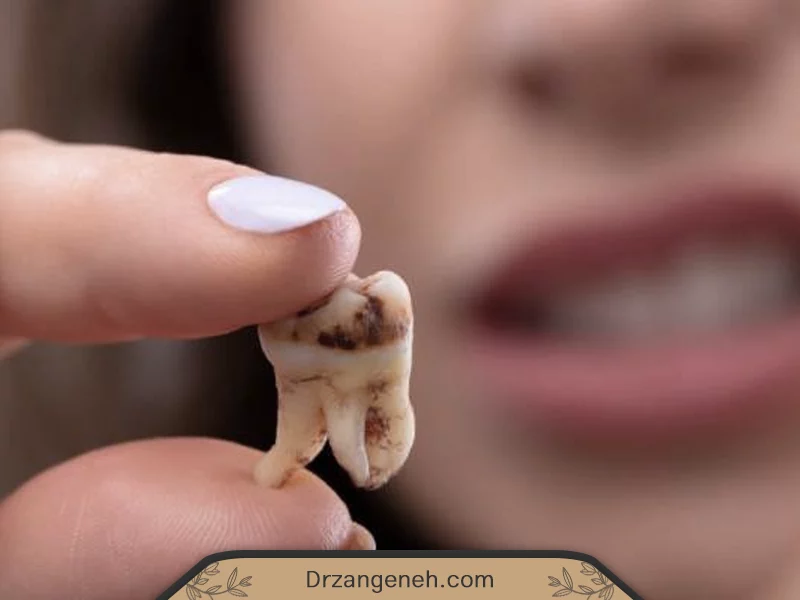 با دندان چرک کرده چه کنیم