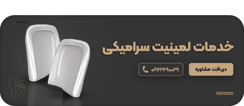 ارتودنسی 14 خدمات لمینیت سرامیکی